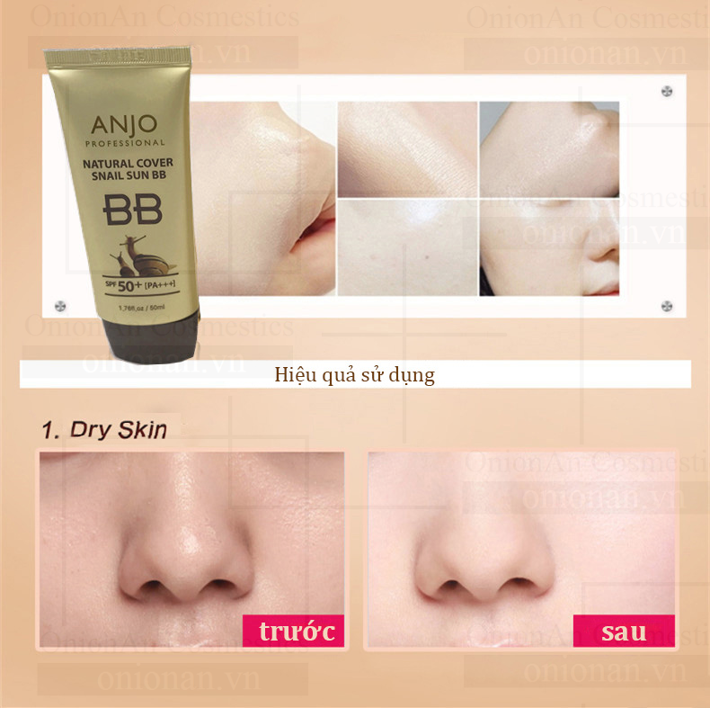 Kem Nền Chống Nắng Ốc S&ecirc;n Anjo Natural Cover Snail Sun BB SPF50+ PA+++